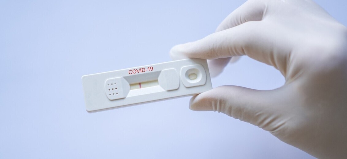 EEOC Says Employers Can Test Employees For Covid-19
